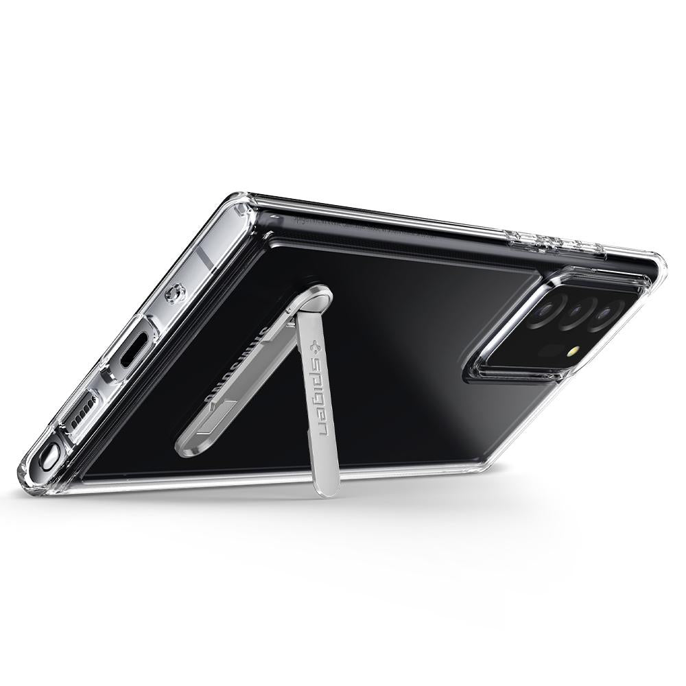 ACS01395