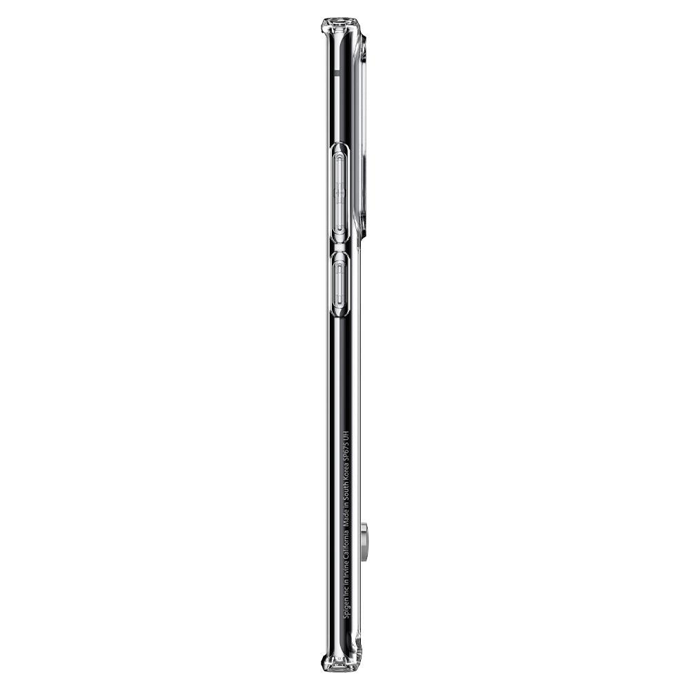 ACS01395